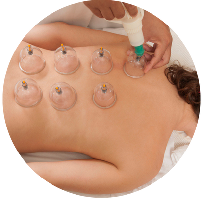 拔罐療法