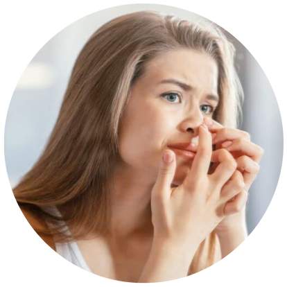 增加產生暗瘡的機會