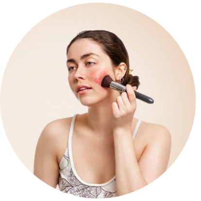 皮膚長期泛紅刺痛