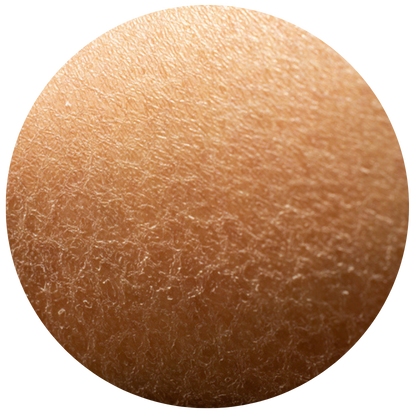 敏感性或極乾膚質