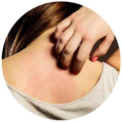 極敏感性皮膚的人士