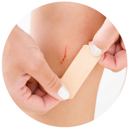 脫毛部位有傷口的人士