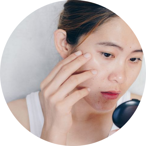 皮膚長期不舒適