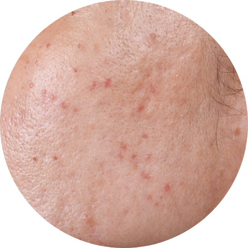 遺傳性敏感體質