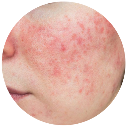 接近全禿的人士