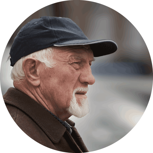 頭髮不明顯稀疏的人士