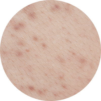 頭髮不明顯稀疏的人士