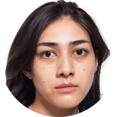 荷爾蒙失調人士