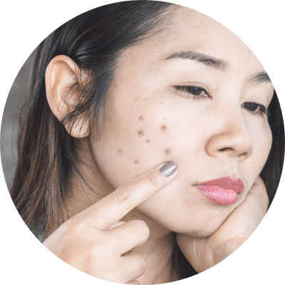 有機會不能消退