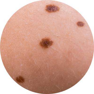 出現在面頰位置