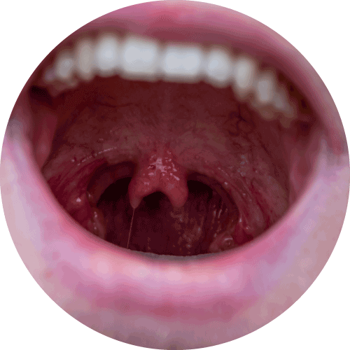 接近全禿的人士