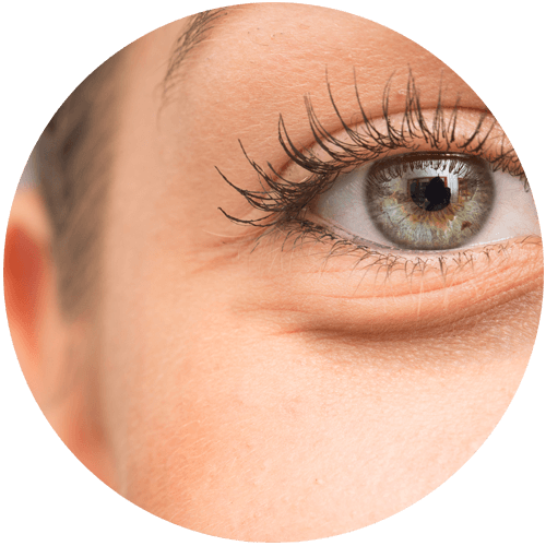 眼周皮膚沒彈性