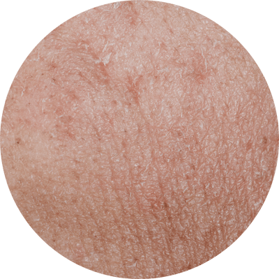 頭髮不明顯稀疏的人士