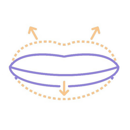 毛囊單位移植術 (FUT)