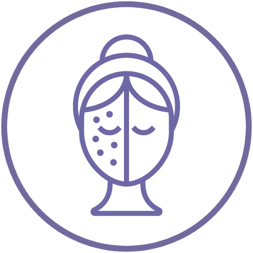 撫平凹凸洞、暗瘡印