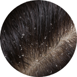 接近全禿的人士