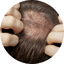 有蟹足腫體質的人士