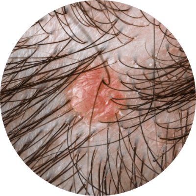 要求過高的人士