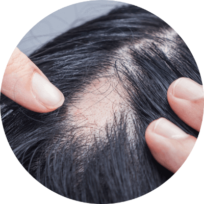 頭髮不明顯稀疏的人士