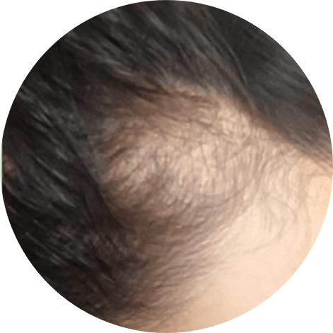 頭髮不明顯稀疏的人士