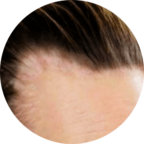  掉髮量異常大增 