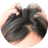 頭髮不明顯稀疏的人士