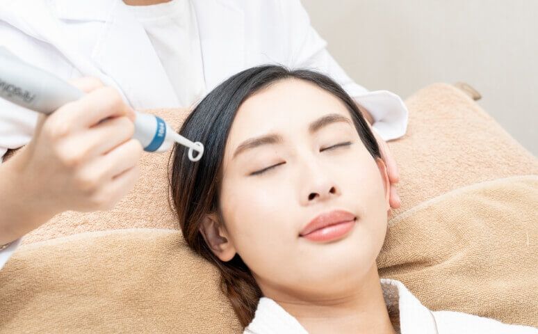 進行 F8 生髮療程