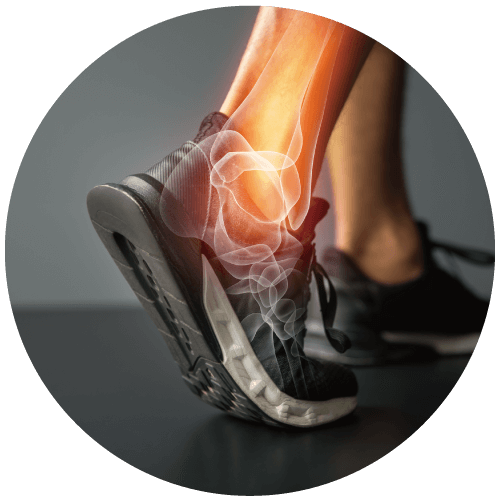 
膝或踝關節損傷者