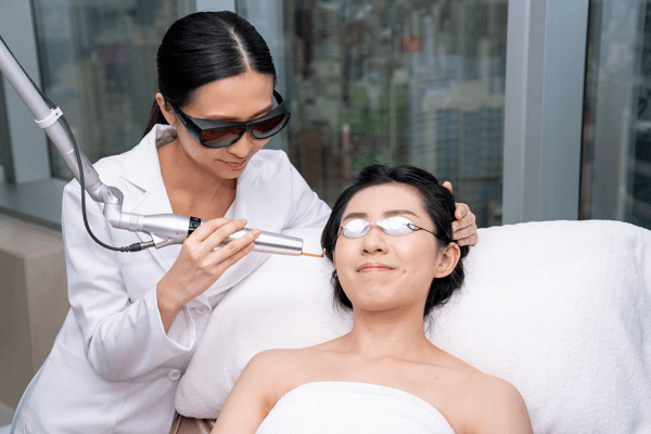 進行激光去斑療程